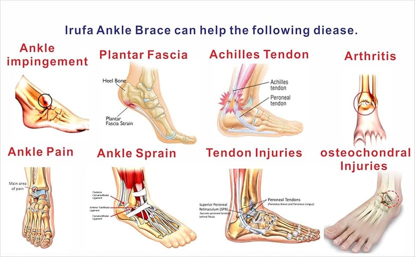 IRUFA, AN-OS-11,3D Breathable Elastic Knit Patented Fabric Adjustable Athletics Achillies Tendon Ankle Wrap, Plantar Fasciitis, Pain Relief for Sprains, Strains, Arthritis and Torn Tendons (S/M)